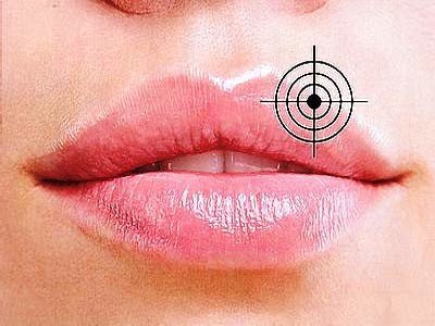 Герпес на губах   як швидко вилікувати застуду, ознаки і симптоми герпесу