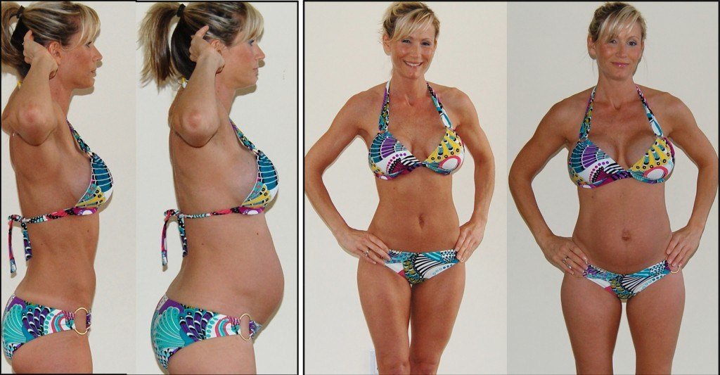 Як прибрати живіт після пологів | Як швидко прибрати живіт після пологів Як прибрати живіт після пологів | Як швидко прибрати живіт після пологів