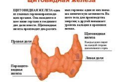 Видалення щитовидної залози: наслідки у жінок