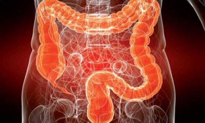 Підвищений газоутворення в кишечнику після їжі: причини, лікування, що робити