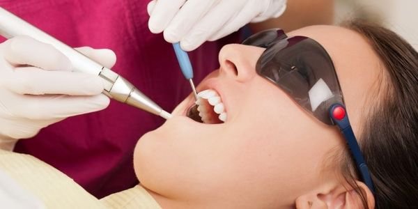 Імплантація зубів: чутки і реальність. Як вибрати імплантант