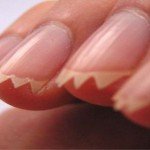 Як перестати гризти нігті | Як перестати гризти нігті дітям Як перестати гризти нігті | Як перестати гризти нігті дітям