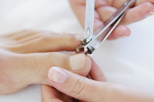 Чим лікувати оніхолізисом на нігтях?