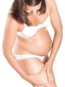 Варикоз під час вагітності