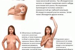 Операція з видалення раку молочної залози