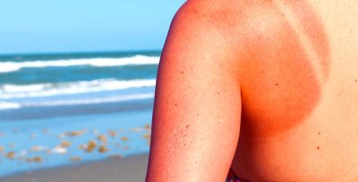 Білі пігментні плями на шкірі: чому зявляються на тілі, лікування білих точок