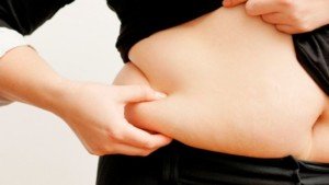 Зайва вага і варикоз: чому необхідно схуднути?