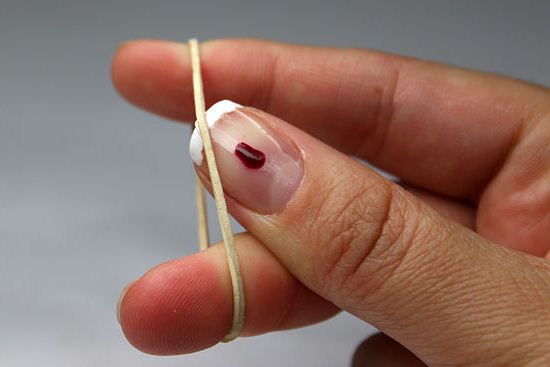 Як перестати гризти нігті | Як перестати гризти нігті дітям Як перестати гризти нігті | Як перестати гризти нігті дітям