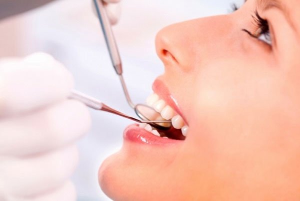Зубні імплантати та їх вартість