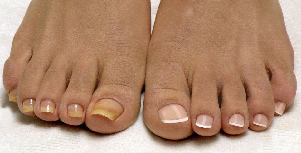 Нарощування нігтів на ногах — красиві нігті в літньому сезоні