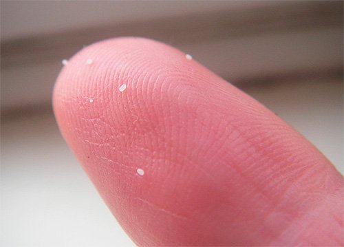 Статеві блохи і як від них позбавитися Статеві блохи і як від них позбавитися