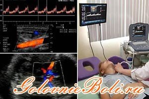 УЗДГ судин головного мозку (ультразвукова доплерографія)