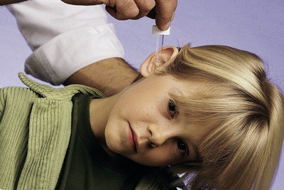 Середній отит   причини, симптоми, лікування, діагностика