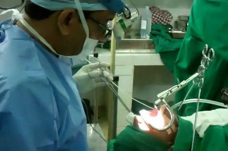 Хронічний тонзиліт і рецидивуючий тонзиліт