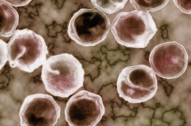 Уретрит   причини, симптоми, методи лікування