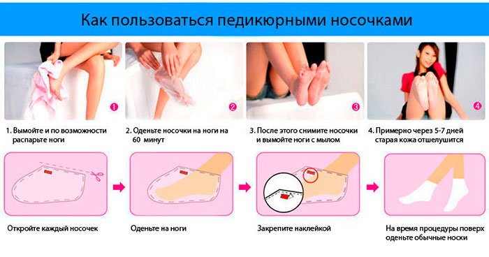 Шкарпетки для педикюру отшелушивающие: відгуки, інструкція по застосуванню