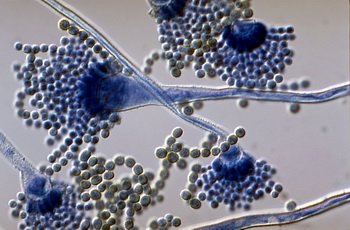 Зовнішній отит   причини, симптоми, методи лікування