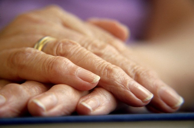 Реактивний артрит причини, симптоми, лікування Реактивний артрит причини, симптоми, лікування