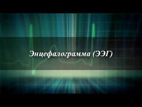 Електроенцефалографія головного мозку