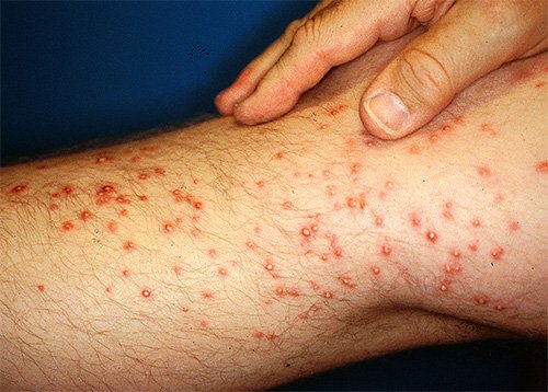 Мурахи бульдоги: опис життя і фото цих комах