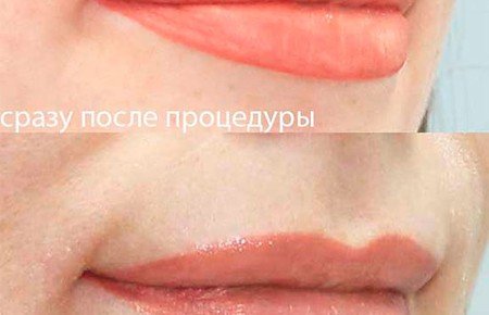 Татуаж губ з розтушовуванням: фото природний колір