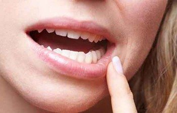 Болить десна   що робити?