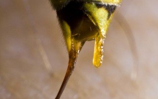 Укус бджоли: перша допомога, лікування, симптоми (фото)
