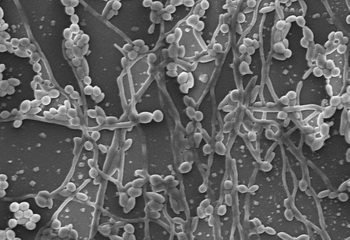 Чим небезпечна молочниця для плода під час вагітності