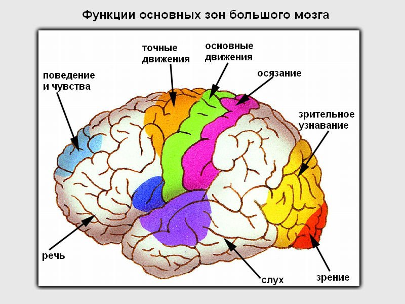 Коли виникає параліч лівої сторони при інсульті