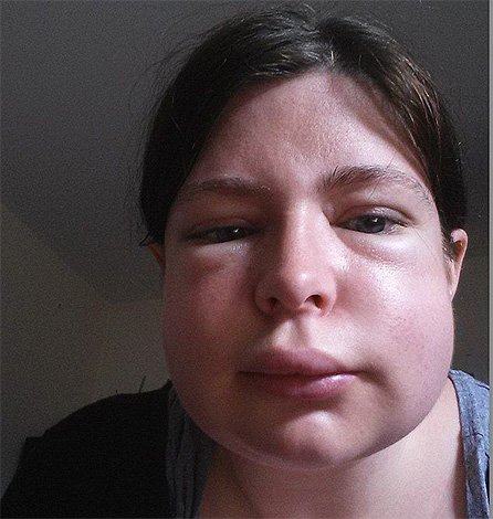 Шершень звичайний і його фото: чи потрібно боятися укусу цієї комахи? Шершень звичайний і його фото: чи потрібно боятися укусу цієї комахи?