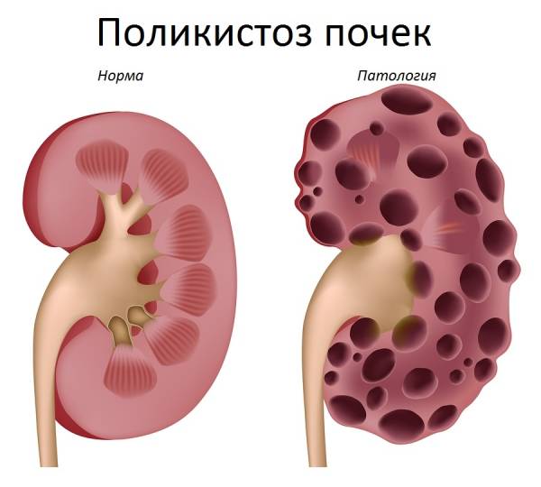 Полікістоз нирок у кішок: симптоми, лікування та профілактика