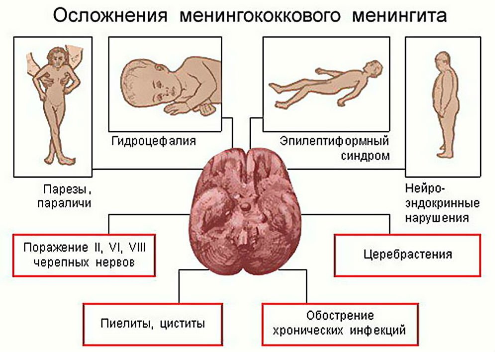 Що таке органічне ураження головного мозку, його симптоми та причини