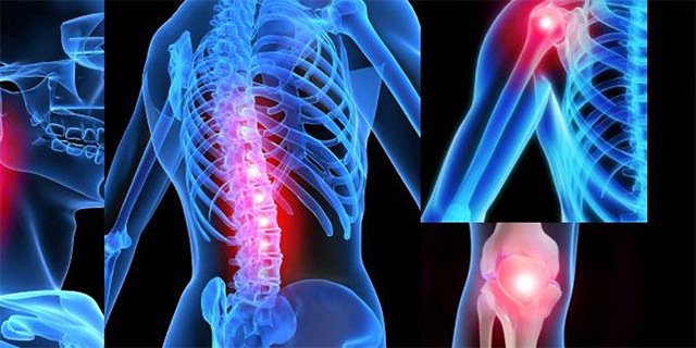 Хвороба Лайма або кліщовий бореліоз: симптоми, лікування, фото