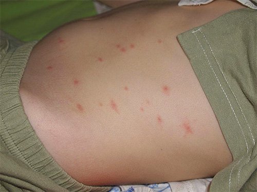 Чи небезпечні блохи для людини: що важливо знати