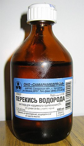 Перша допомога при укусах комах: що робити насамперед Перша допомога при укусах комах: що робити насамперед