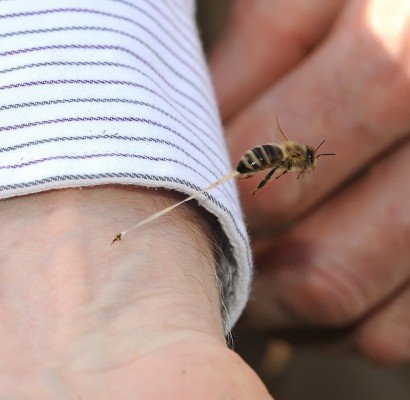 Укус бджоли: перша допомога, лікування, симптоми (фото)