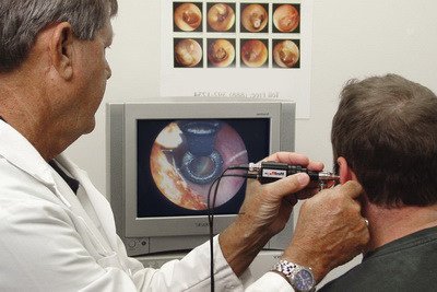 Середній отит   причини, симптоми, лікування, діагностика