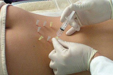 Які існують уколи від болю в спині