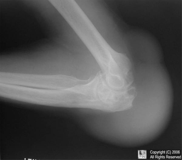 Бурсит у собак   все про запаленні суглобів