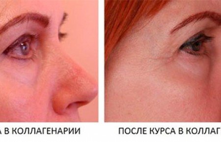 Коллагенарій: що це, показання, відгуки