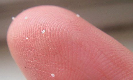 Домашні блохи і як від них позбавитися