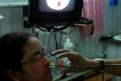 Збільшені аденоїди у дитини – причини, симптоми, лікування