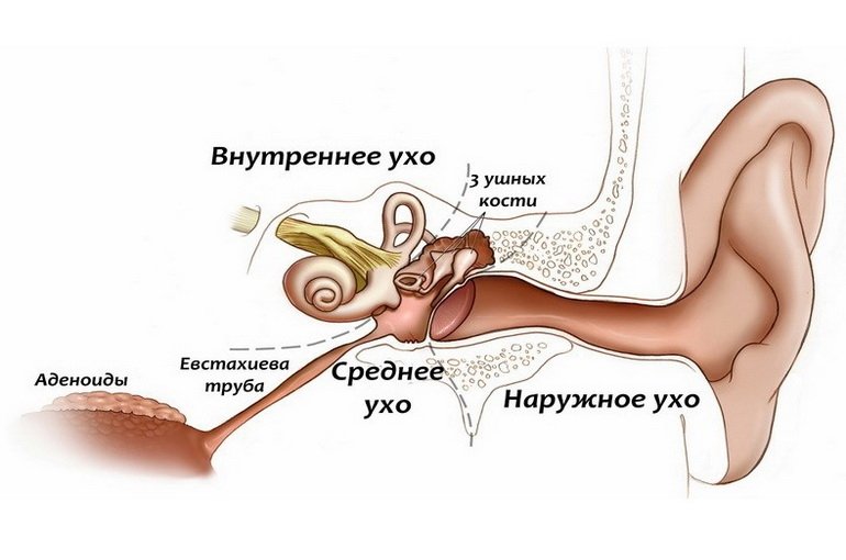 Хронічний отит   причини, симптоми, лікування