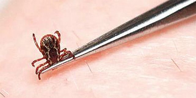 Імуноглобулін проти кліщового енцефаліту – екстрена профілактика при укусі кліща