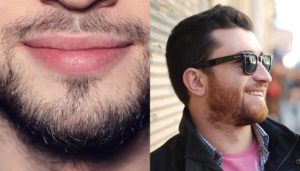 Як випрямити бороду: чому стирчить борода, способи випрямлення бороди