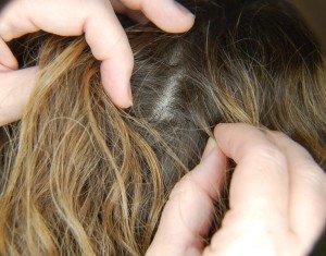 Як позбутися від гнид на довгому волоссі: інструкція по застосуванню