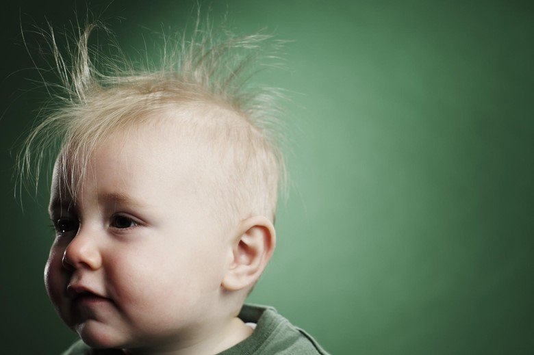 Аполеция (гніздова або вогнищева) у дітей, причини і лікування випадіння волосся