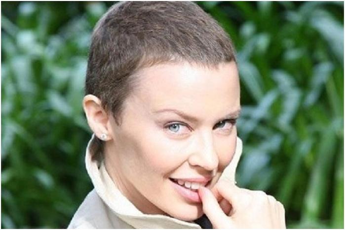 Відновлення волосся після хіміотерапії: чому випадають і коли починають рости