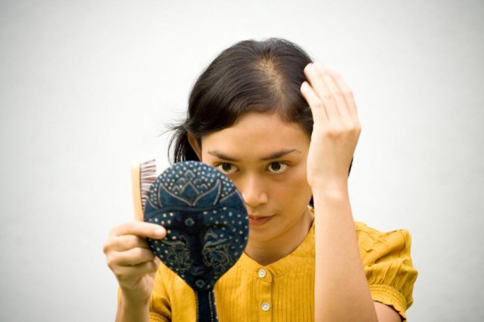 Причини і лікування лисини (пустоти) на голові у жінок: як приховати недуг
