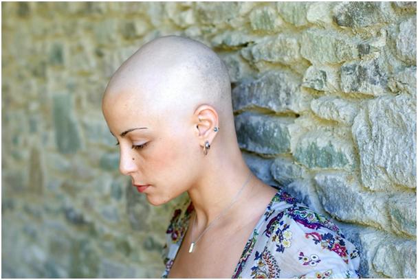Відновлення волосся після хіміотерапії: чому випадають і коли починають рости